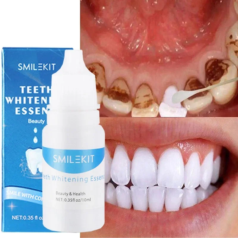 

Teeth Whitening Serum Remove Stains Smoke Coffee Plaque Deep Cleaning Dental Oral Hygiene Fresh Breath Tooth Care Products