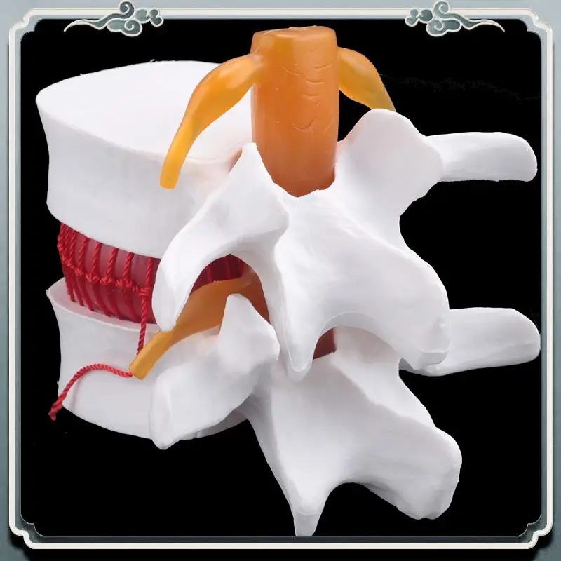 

Premium Human Anatomy Skeleton Spine Lumbar Disc Herniation Teaching Model Brain Skull Traumatic School Supplies Instrume