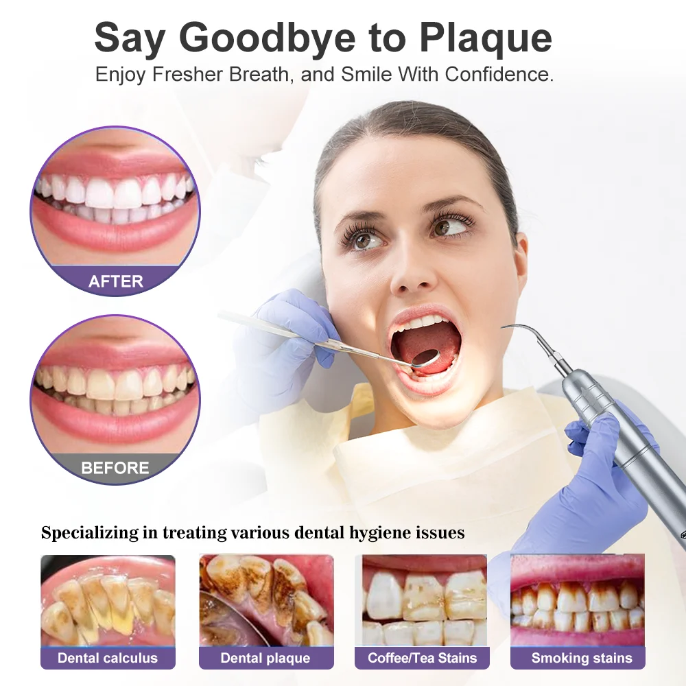 หัวขูดหินปูนลมสำหรับทันตกรรม แ - Teeth Whitening Tips บทวิจารณ์และราคา