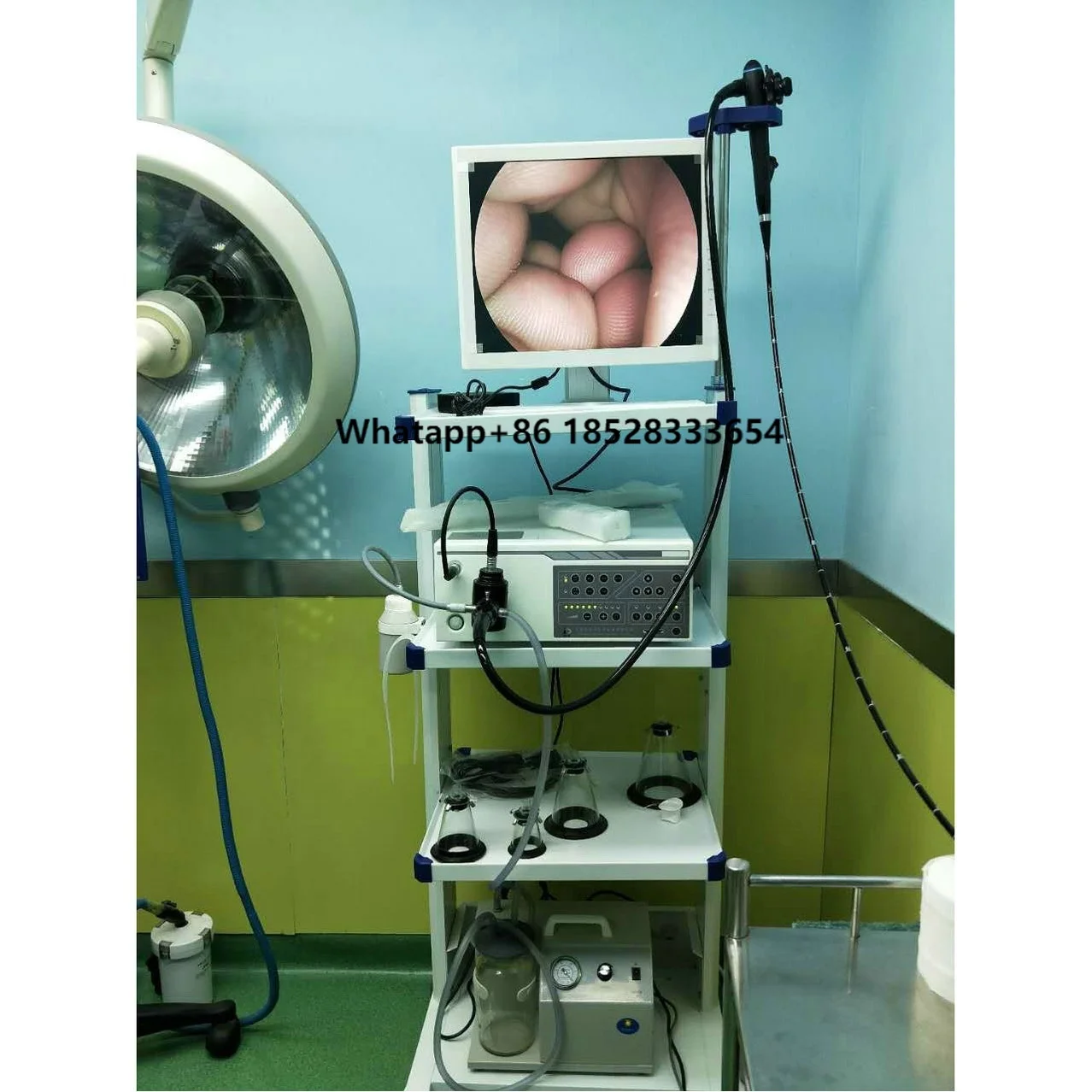 Medical Flexible Endoscope/CMOS Portable Video Gastroscope/colonoscope Endoscopy Set For Human & Veterinary