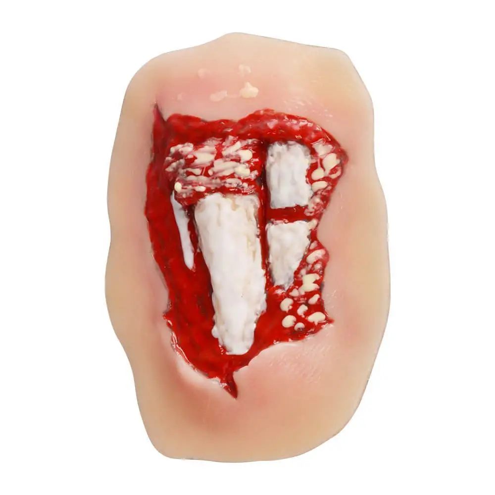 Ultrassist Open Leg Fracture Wound Moulage Adhesive Silicone Trauma Model for EMT First Aid Nursing & Combat Care Training