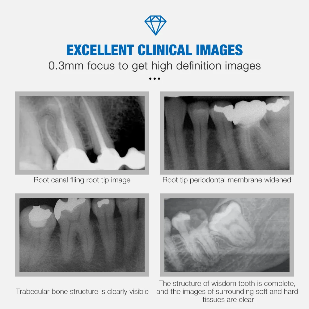 جهاز أشعة سينية محمول للأسنان ، كاميرا أشعة سينية رقمية ، RVG لاسلكي رقمي متوافق ، معدات نظام استشعار الصور في المخزون ، المكسيك