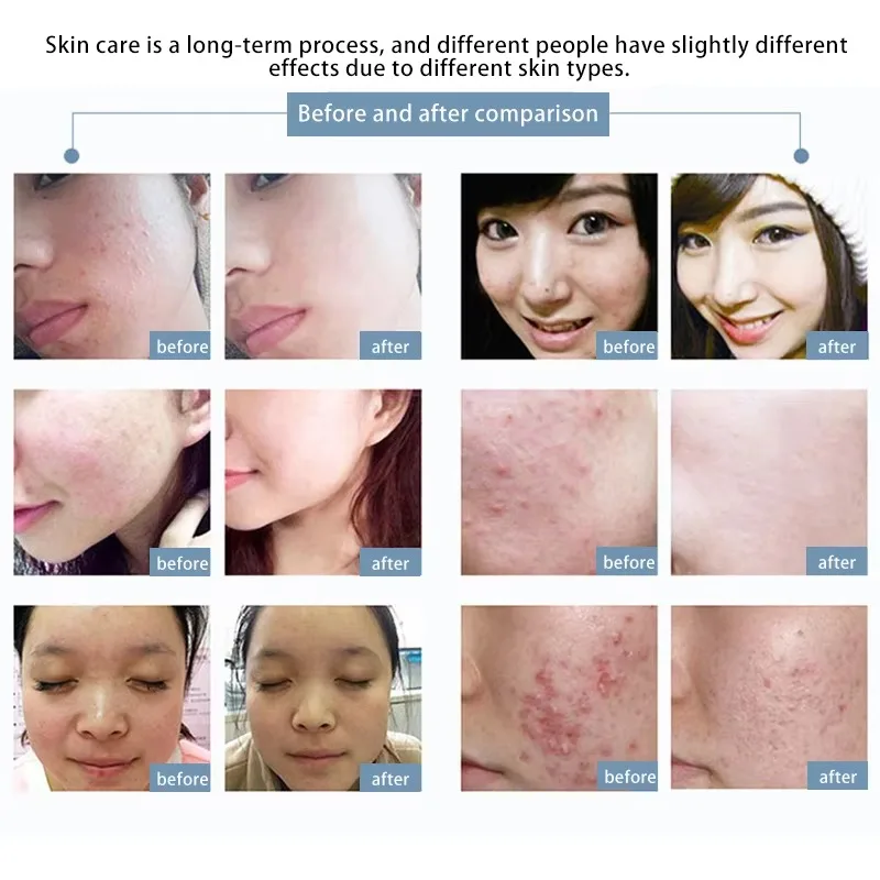 لوحة LED حمراء بالقرب من الأشعة تحت الحمراء 660 نانومتر 850 نانومتر جهاز علاج بالضوء الأحمر للألم والجلد والانتعاش والنوم ولوحة طاقة عالية محمولة منزلية