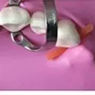 

2Pcs Dental Rubber Dam Stabilizing Cord Elastic Wedges Clamps Sheets Rubber Barrier Wedge Line 2.1M /dia 1.8Mm