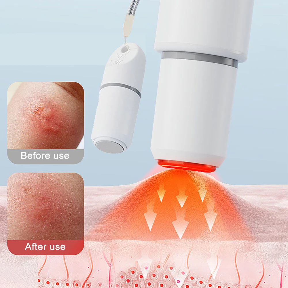 

Electronic Pulse Mosquito Bite Pen Chemical-Free Mosquito Insect Relieve Itching Pen Potable Anti-itch Pen for Camping Travel