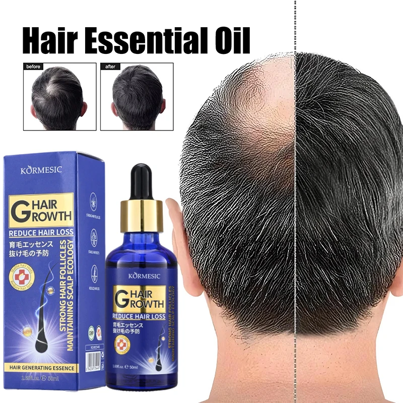 

Hair Growth Essence Effectively Prevents Hair Loss Strongly Promotes Hair Regeneration Repairs Loss Scalp Powerful Hair RootCare