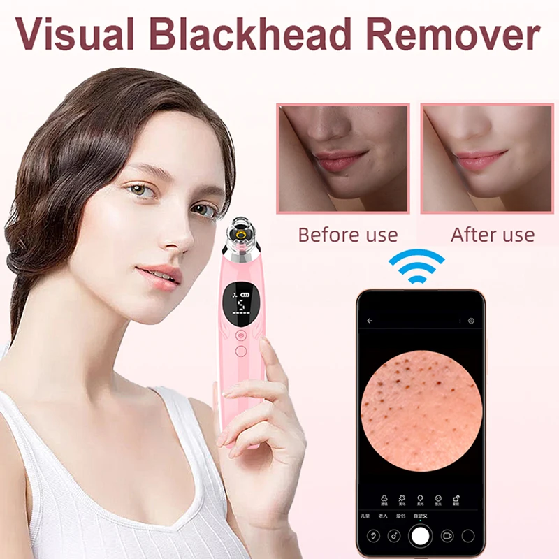 

Facial Pore Deep Cleaner Vacuum Extractor Visual Black Head Removal with Camera Acne Point Noir Blackhead Remover Machine