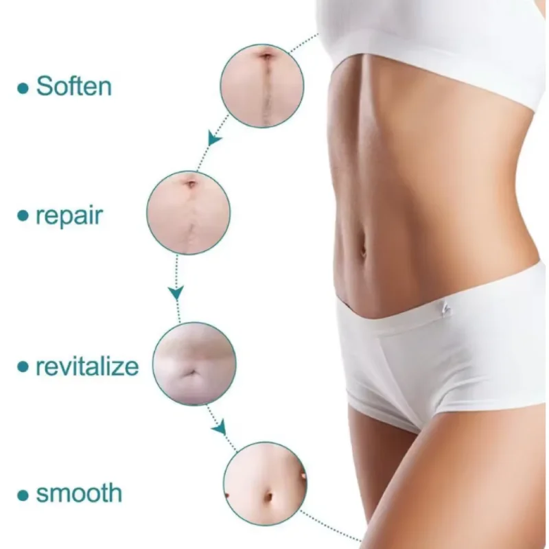 4 سنتيمتر x 150 سنتيمتر سيليكون ندبة ورقة إزالة شرائط هلام السيليكون ندبة قطاع لحب الشباب كيلويد جراحة حرق العلاج ندبة التصحيح Hot البيع