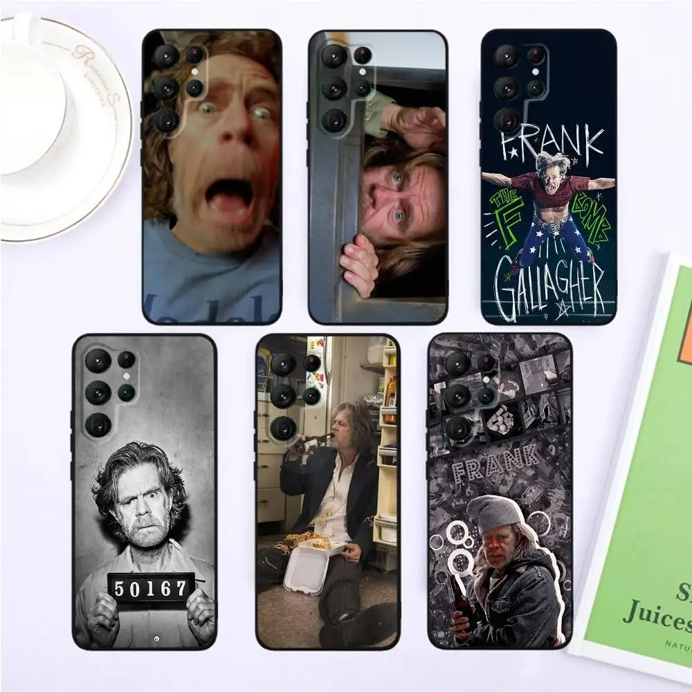 

Frank Gallagher S-Shameless Phone Case For Samsung S25,S24,S23,22,21,Ultra,Pro,S10,S30Plus,20lite Black Cover