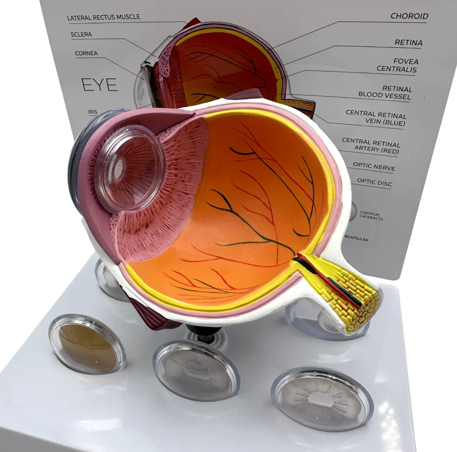 Eyeball Model Anatomical Eye Model IE-02 Medical Learning and Teaching Instrument Medical Science Teaching Resources