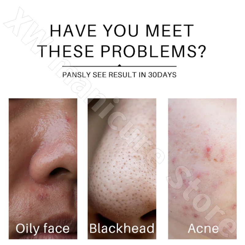 Yeast No-wash Hydrating Sleep Mask Deep Moisturizing Nourishing Shrinking Pores Brightening Skin Tone Reducing Melanin Mask