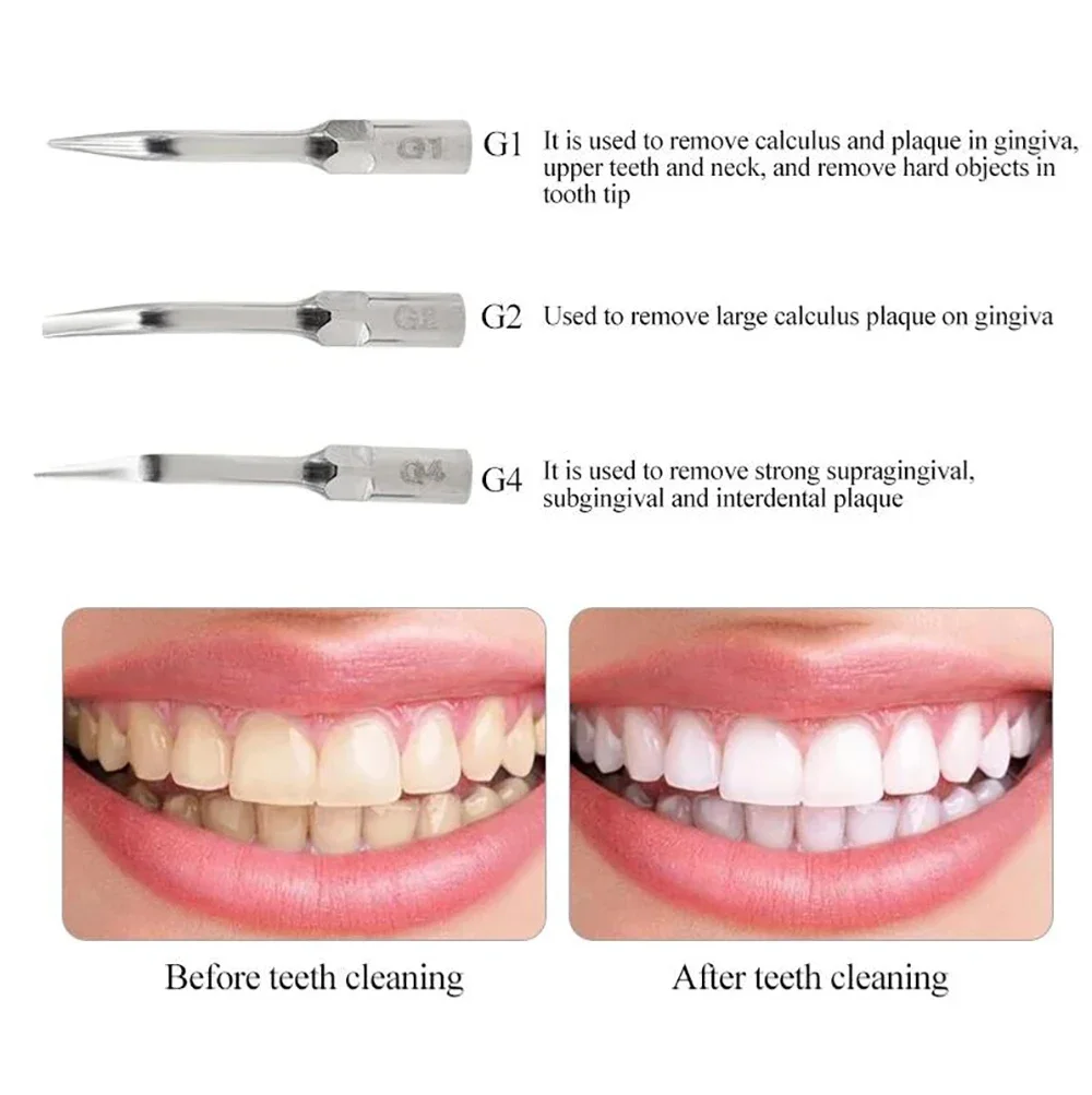 

2 Hole Dental Ultrasonic Air Scaler Handpiece with 3 Tips for Air Scaling Polishing and Teeth Whitening Cleaning Tool