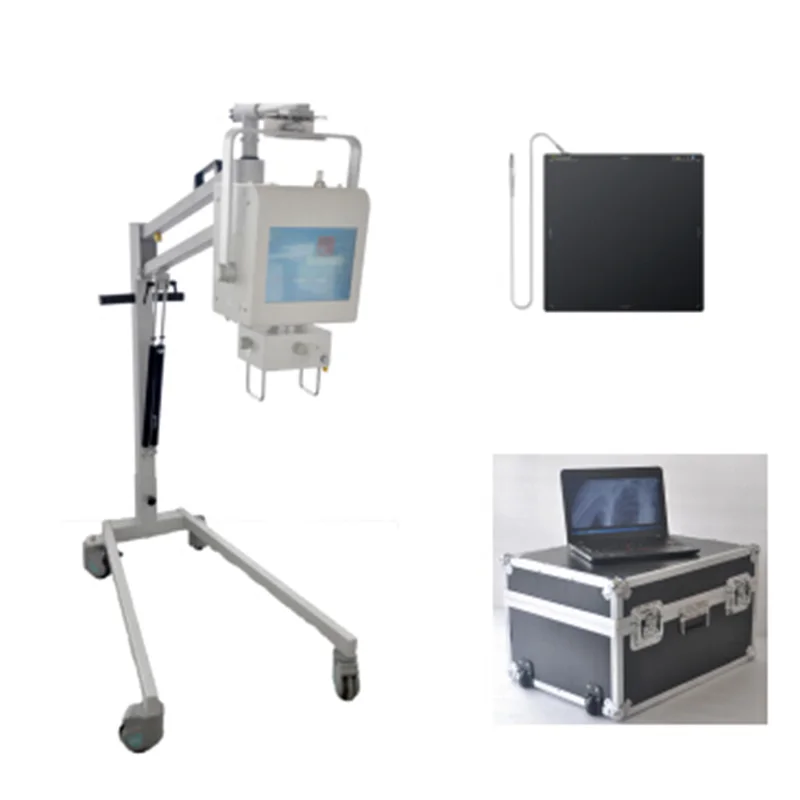 Portable X ray Machine Price Digital Scanner Medical X-ray Sensor Printer Equipments Detector Mobile X-rays System