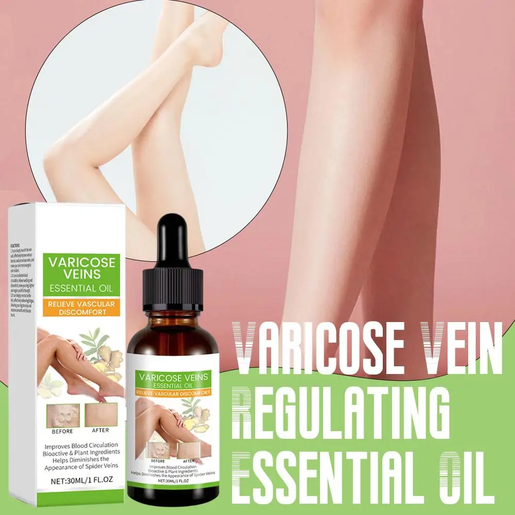 Huile essentielle hydratante pour massage des veines des jambes, soin réparateur des varices, 30ml, C4A5