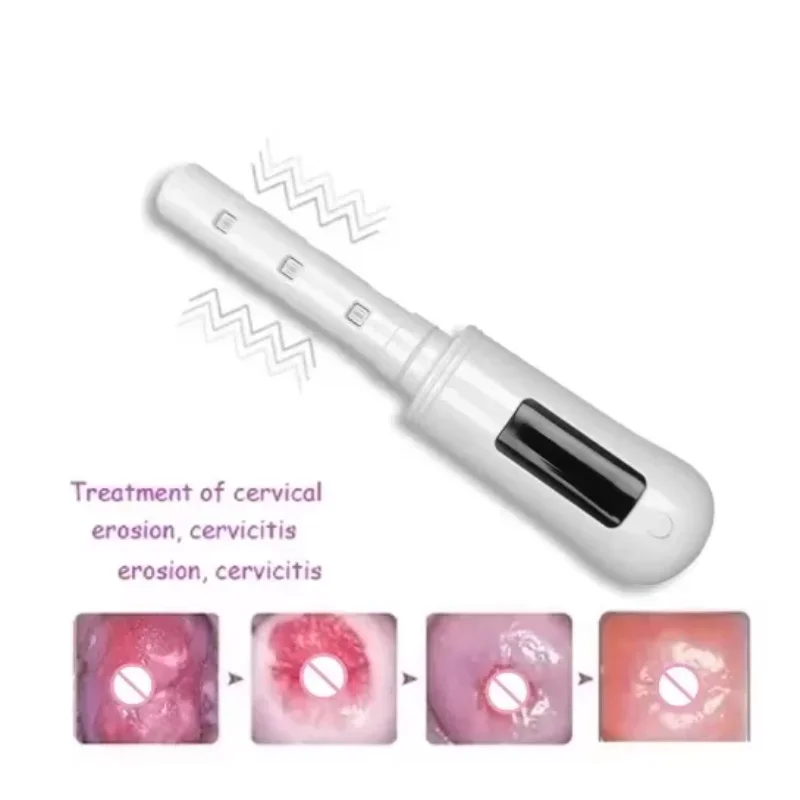 Mild Cervical Erosion Cold Laser Therapy Device Vaginal Tightening Rejuvenation Massager Red Blue Light Gynecology Laser Device