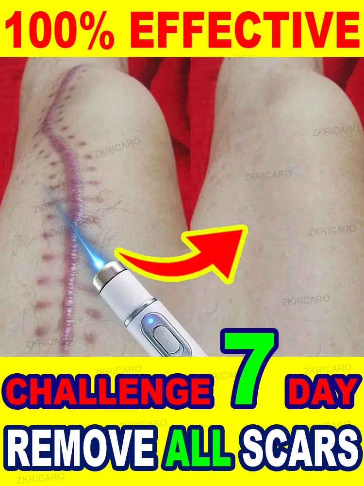 Sin cicatrices, piel lisa.