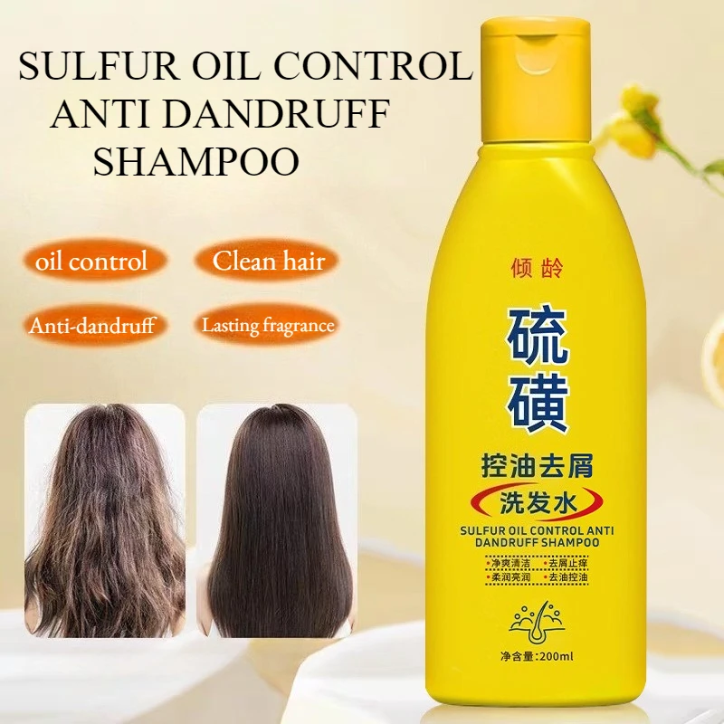 200ml Sulfur ANTI DANDRUFF Balancing Shampoo Scalp Purifying Flake Control Oil Regulation, Hydrating Frizz-Free Smoothness