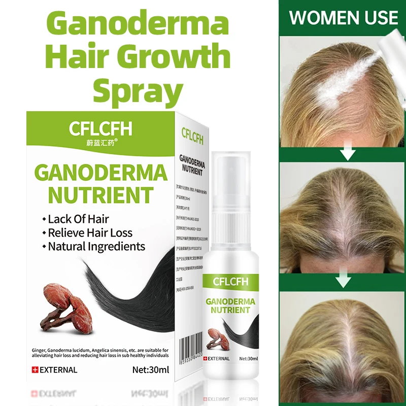 

Hair Growth Treatment Spray Ganoderma Lucidum Ginger Liquid Anti Hair Loss Fast Regrowth Products Scalp Hair Care for Men Women