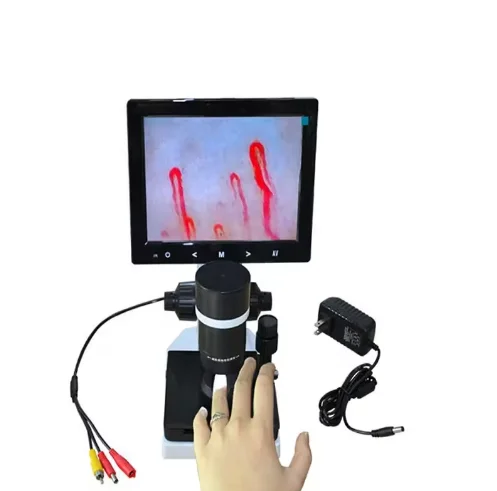 New Observation and Analysis of High Definition XW-880 Fingernail Fold Peripheral Blood Flow Velocity