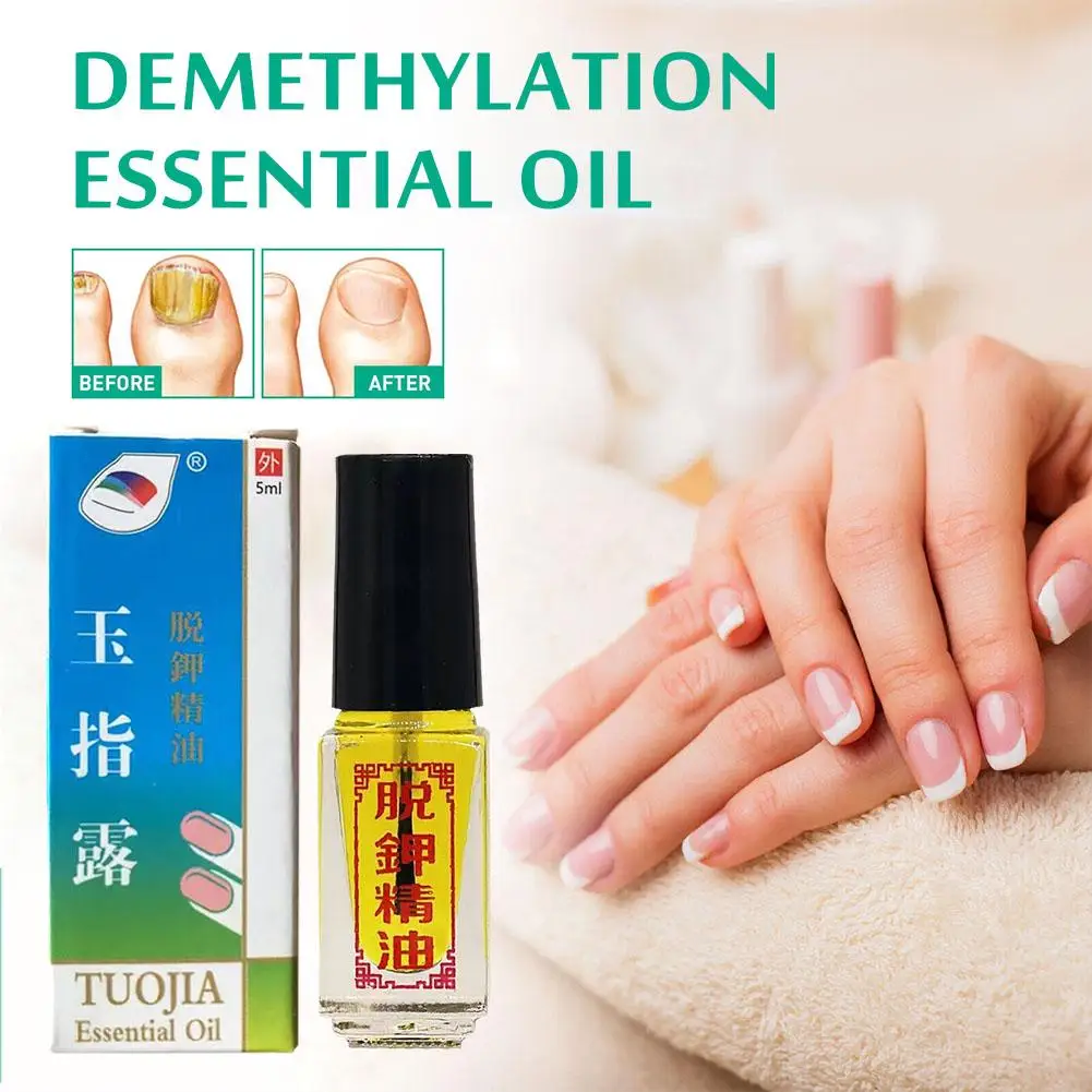 Huile essentielle de traitement des ongles, soin des ongles, antiinfection enzymatique, onychomycose topique, liquide, hydrol D9Q8