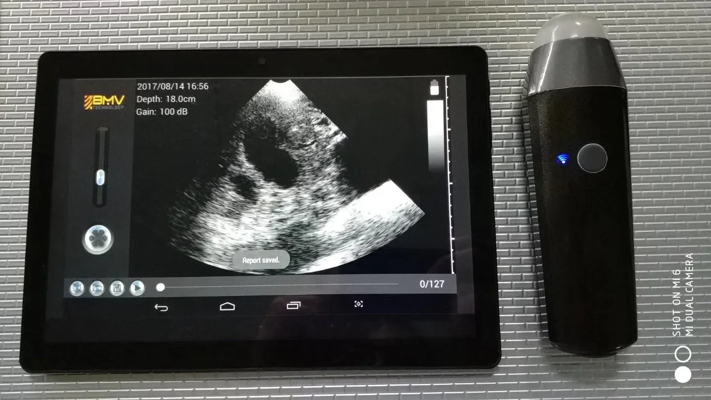 BestScan S3 الماعز اللاسلكي // الأغنام/الخنزير/الخنزير/الخنازير معدات الموجات فوق الصوتية البيطرية المحمولة/آلة/الماسح الضوئي