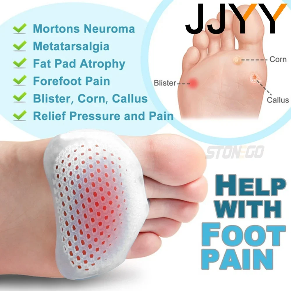 1 Paar weiche Silikon-Vorfußpolster, Wabenkissen, Schmerzlinderung, Bunion-Schutz-Einlegesohlen für Komfort und Unterstützung