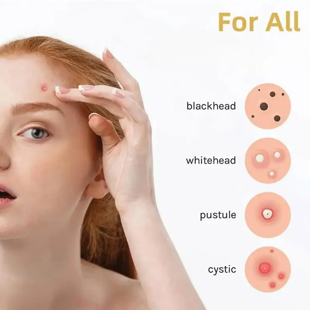 الوجه حب الشباب التصحيح أحجام نقطة مختلطة بثرة بقع غير مرئية العناية بالبشرة تغطية عميقة حب الشباب الجلد ودية بثرة إخفاء ملصق #6