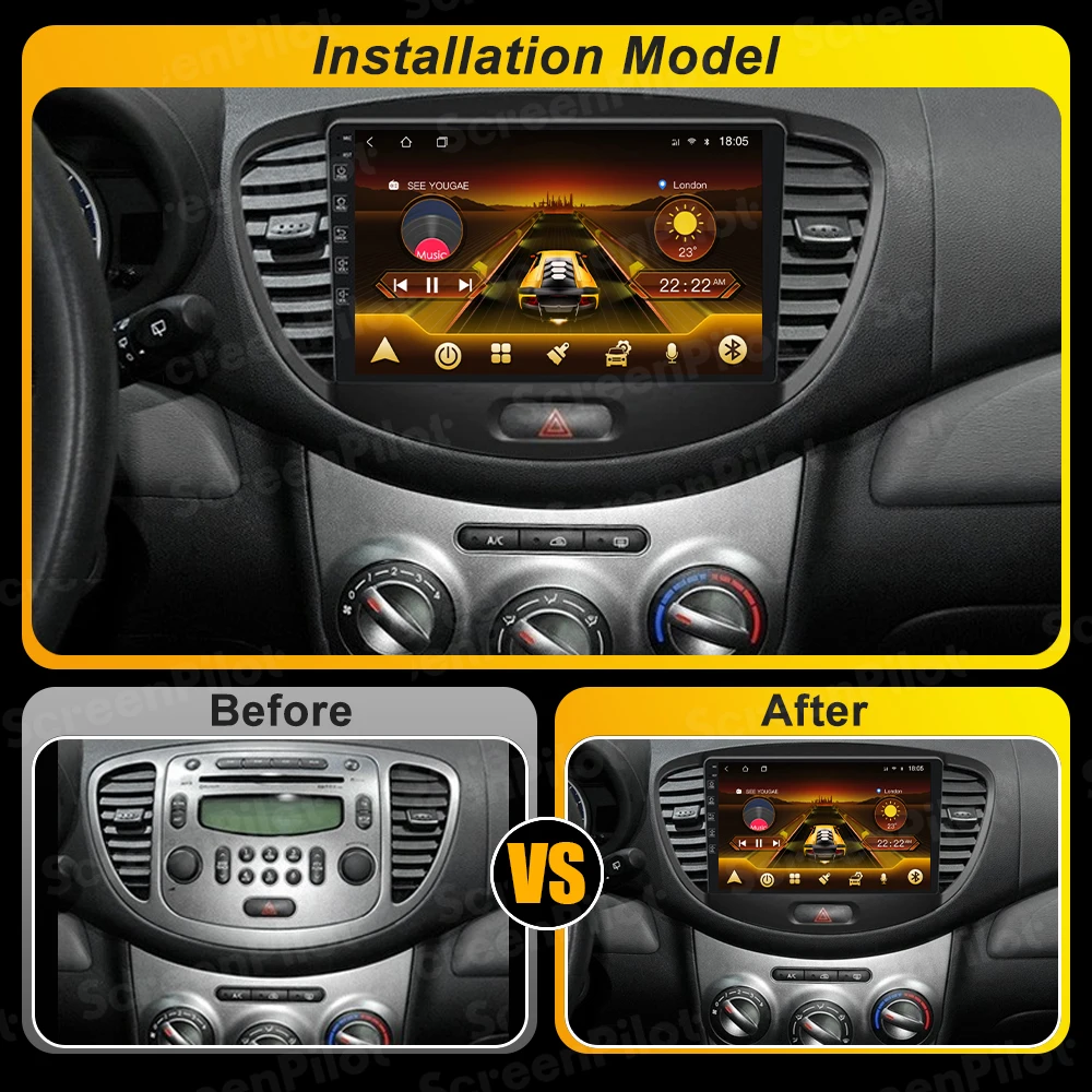 Car Radio For Hyundai I10 2007 2008 2009 2010-2013 Stereo Multimedia Player Android 14 Navigation 2din Carplay 4G GPS