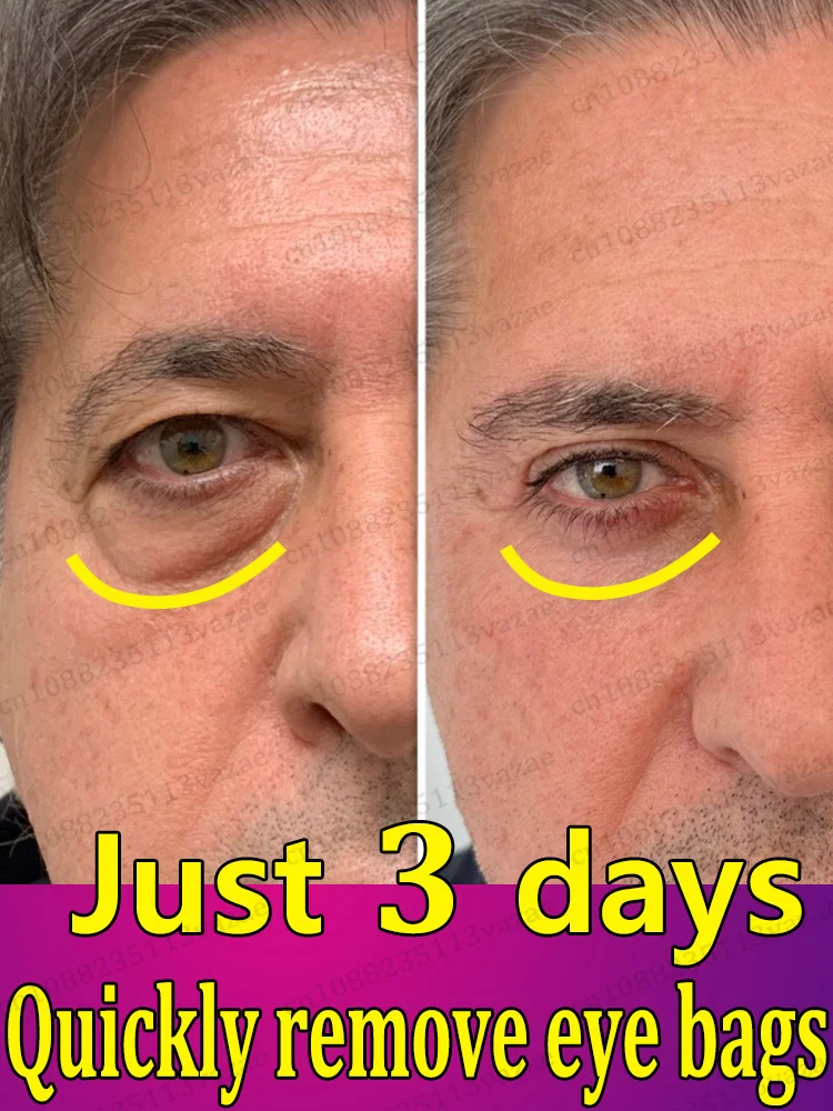 Verstevigt de huid rond de ogen om de jeugdigheid te behouden