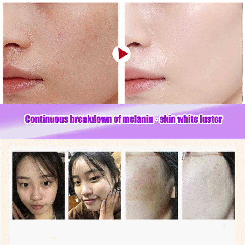 Women's Hydration Blemish Mask Pearl Whitening Mask to Remove Yellow Snow Soft Elegant Blemish Mask