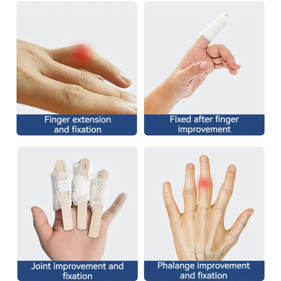 1Pcs Finger Fixation Splint Knuckle Pads 4 Aluminum Bars Reinforcement Fixation Thumb Retainer Ring Finger Bending Straightening