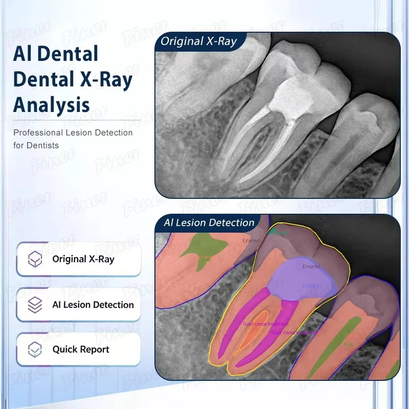 Integrated Sensor X-ray Machine Portable Mini Digital Medical Handheld 3D Scanning Veterinary X-ray Machine