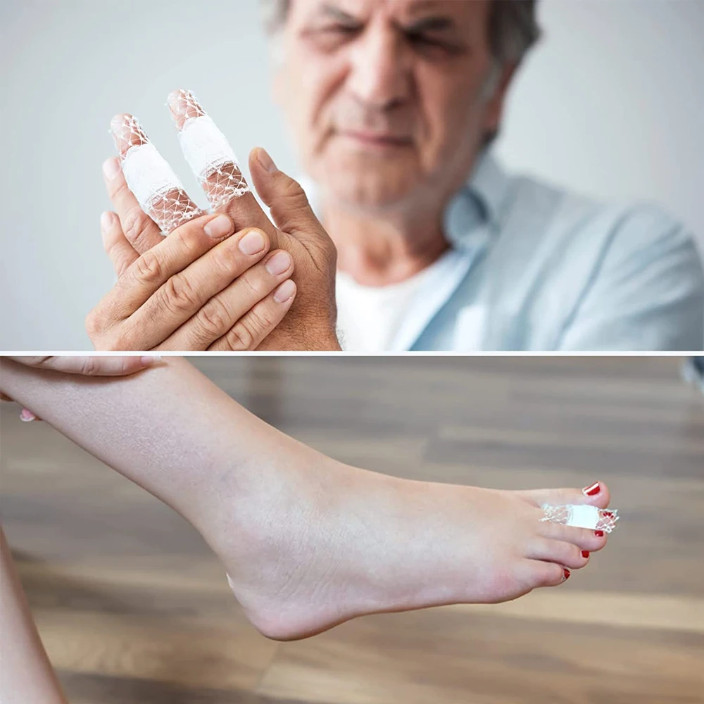 1 Rolle elastisches Netz, Wundverband, Netz, röhrenförmiger Verband, Netzschlauch, röhrenförmiger Gaze-Fix, atmungsaktiver Verbandhalter für Handgelenk, Ellenbogen – Detail 4