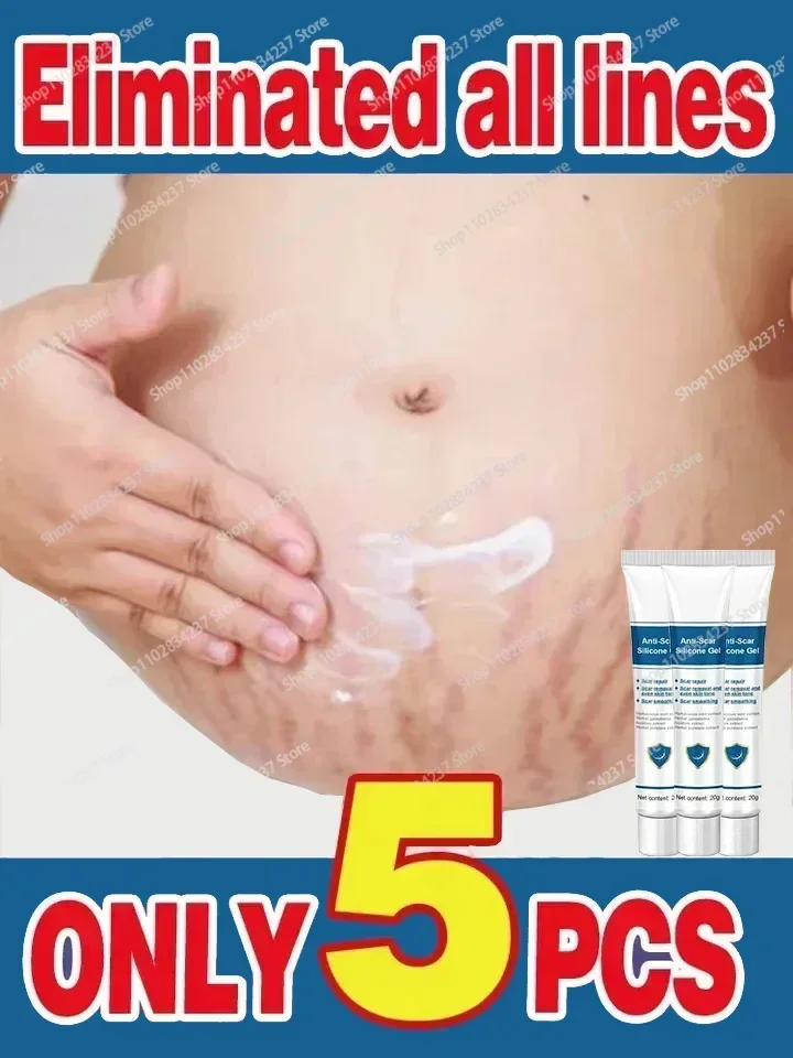 

Eliminate Red White Old Stretch Marks Cream For Pregnancy Postpartum Skin Care Gel