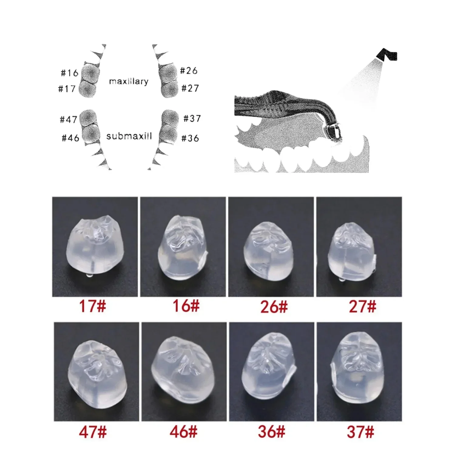 1x Dental Posterior Teeth Aesthetic Printing Mould Kit Professional Clinic Use for Light Cure Composite Restoration Filling Tool