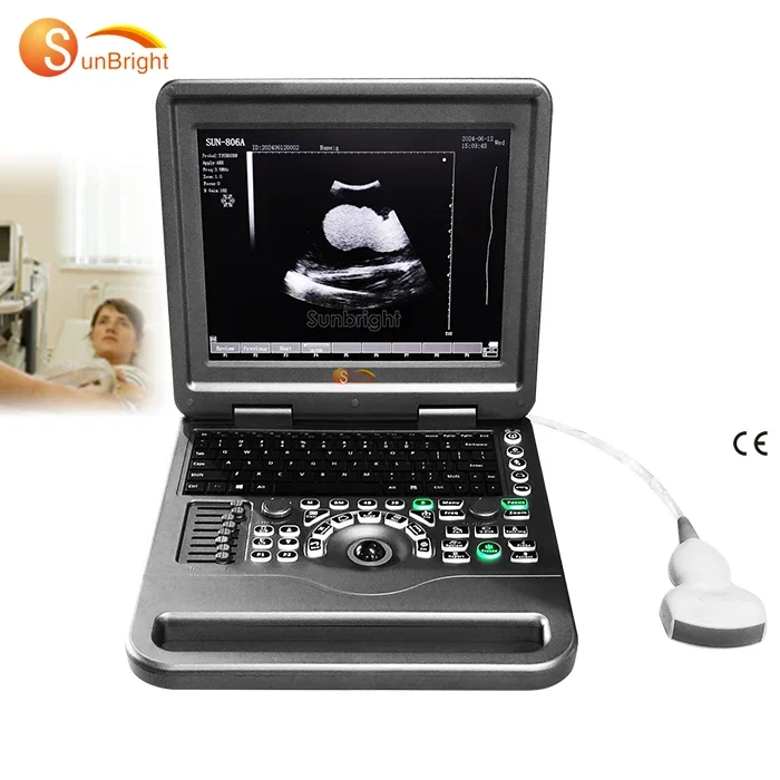 

12-Inch ecografo portatil full digital high-quality low-cost 2D black and white medical ultrasound equipment