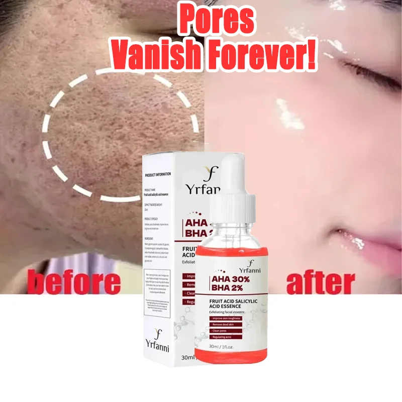 

Salicylic Acid Shrink Pores Serum Exfoliating Moisturizing Nourish Smooth Pores Essence For Acne Blackhead & Pores Skincare