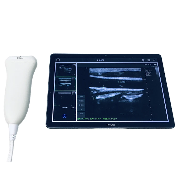 Upgrade Handheld Pocket USB Type C Linear Ultrasound Scanner Probe With Software Veterinary ing Device