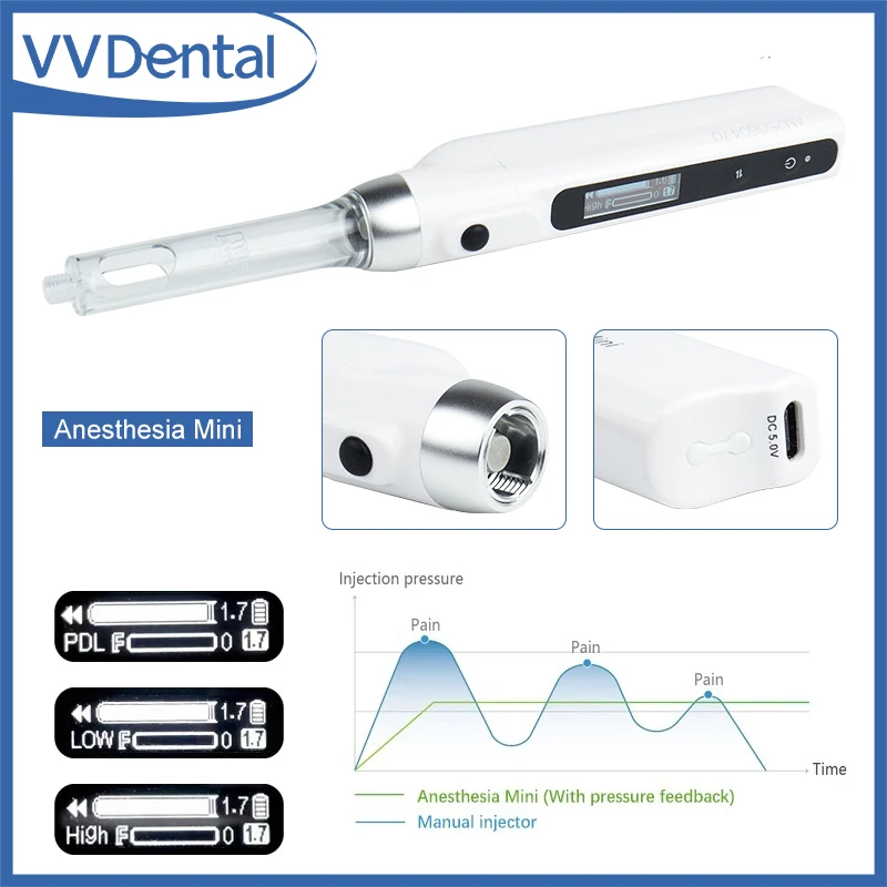 Мини-стоматологические аксессуары, инжектор для анестезии, безболезненная ручка, электрический аспирационный шприц для полости рта, стоматологическое оборудование