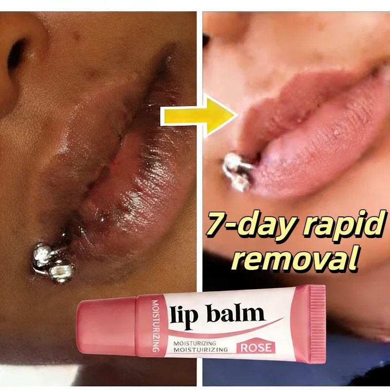 2026 Fade Lip Lines Lighten Melanin Lip Mask Remove Dark Lip Balm Serum Exfoliating Dead Skin Nourishing Repair Lip Care Makeup