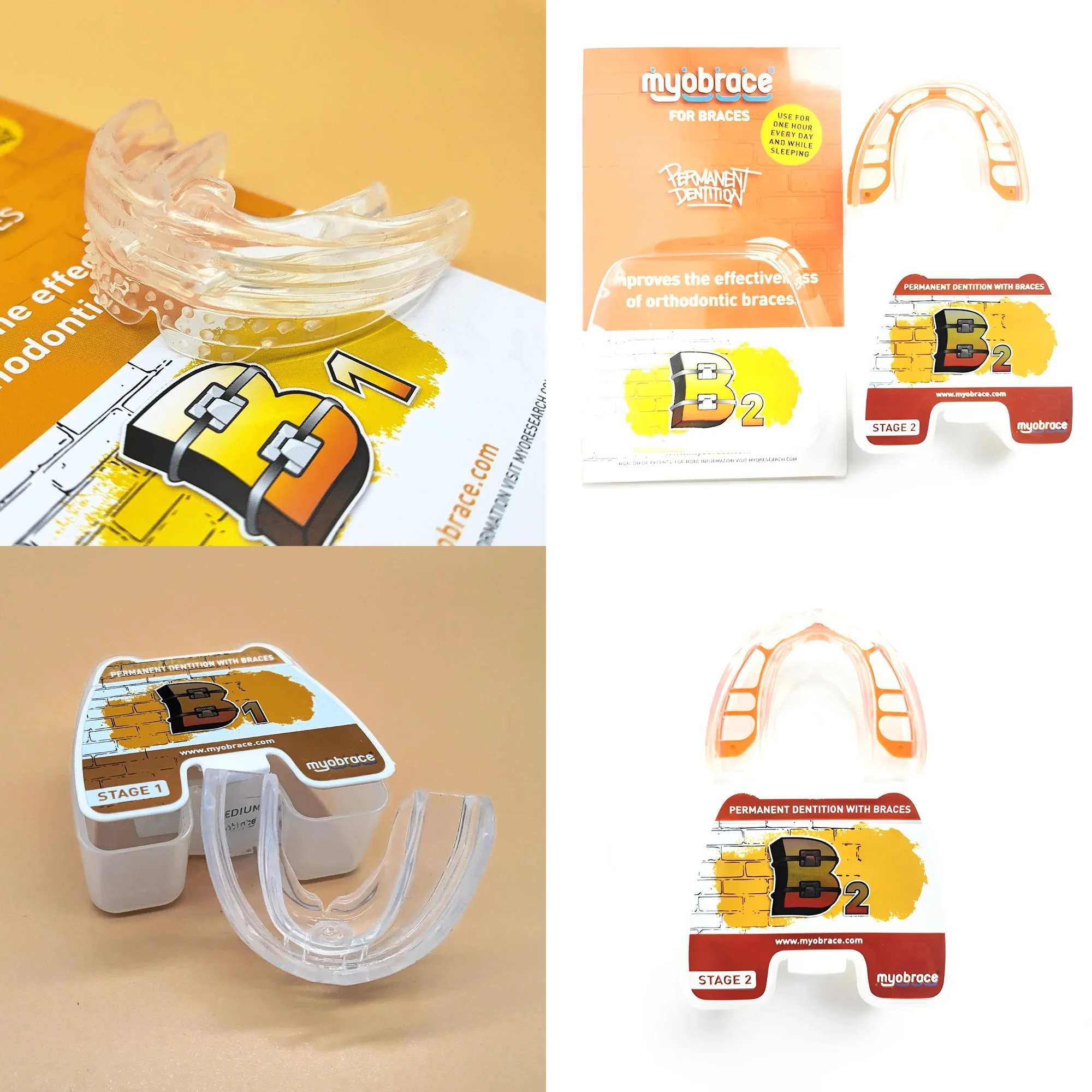 

Myobrace For Braces For Patients Using Braces Or Clear Aligners Orthodontic Appliances Used In Conjunction With Brackets B1/B2