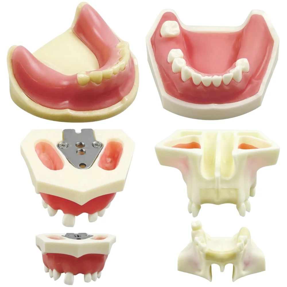 Dental Teeth Model Jaw Implant Practice Demo Typodont Soft Gum Study Teaching Training Oral Model Dentistry Demonstration Tools