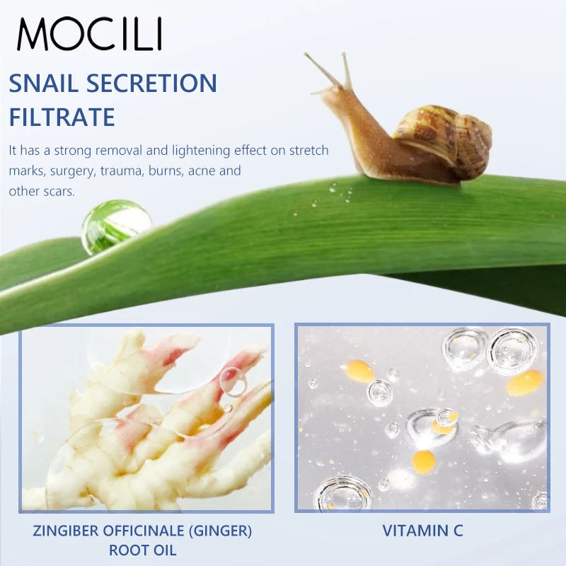 Herbal Scar Removal Cream Treatment Burn Surgical Scar Stretch Marks Acne Spots Repair Pigmentation Body Smooth Beauty Skin Care