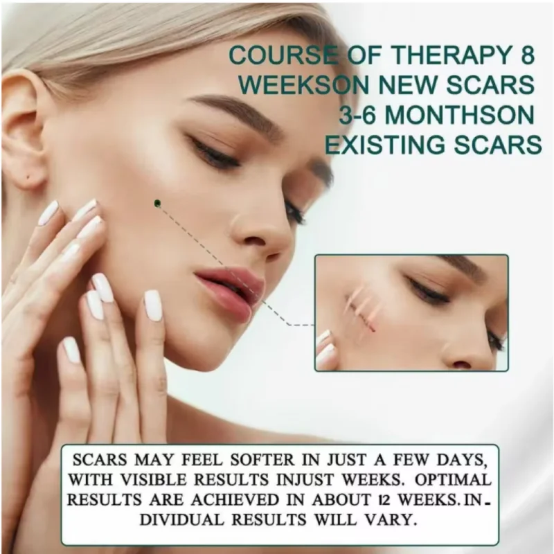 4 سنتيمتر x 150 سنتيمتر سيليكون ندبة ورقة إزالة شرائط هلام السيليكون ندبة قطاع لحب الشباب كيلويد جراحة حرق العلاج ندبة التصحيح Hot البيع