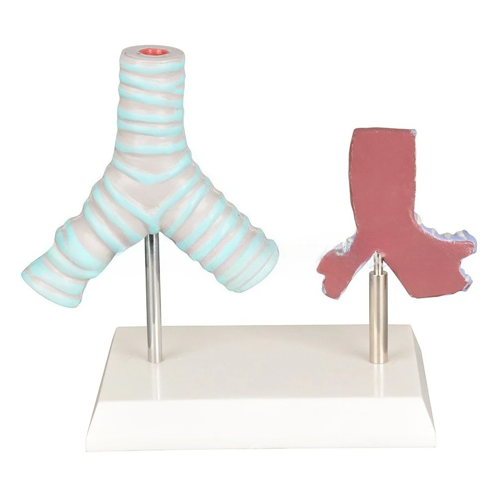Airway Comparison Demonstration Model between Healthy and Smoking People Airway Comparison Model