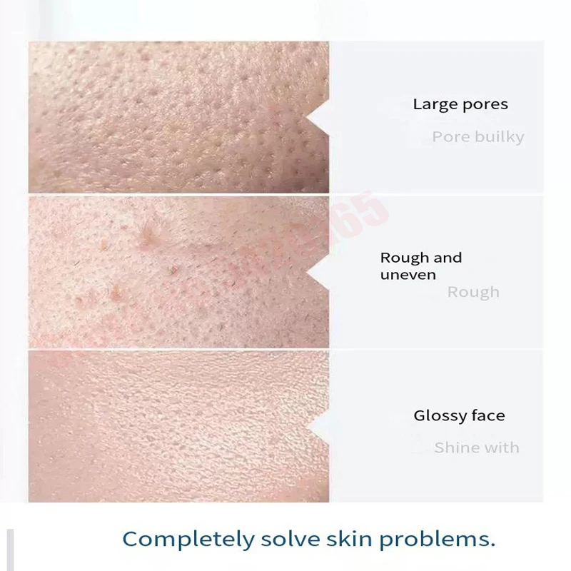 Aqua Peeling Solution PS1 PS2 PS3 PSC 4 Bottles 500Ml Per Bottle Facial Serum Hydra For Normal Skin Microdermabrasion