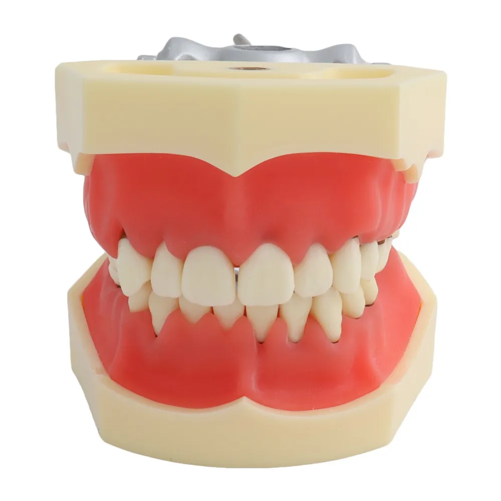 Modelo Periodontal de dientes, modelo Dental de demostración de enseñanza con dientes extraíbles de 27 piezas, estilo ADC