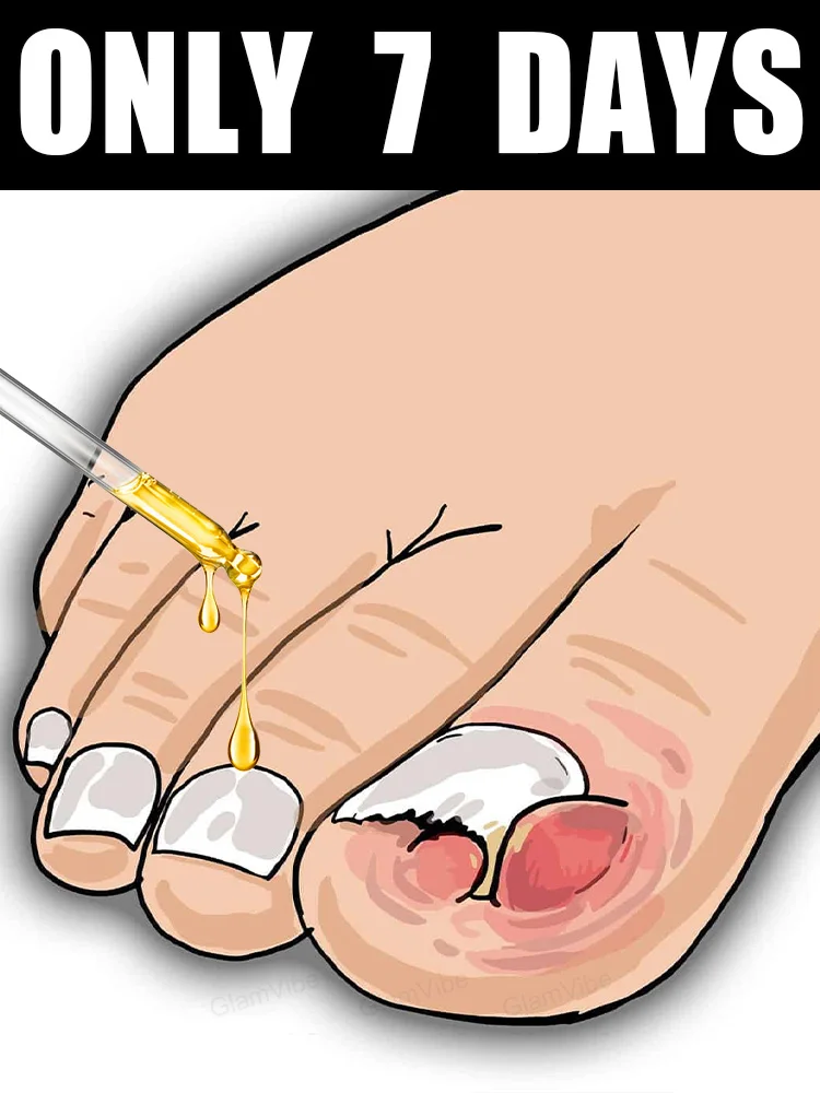 

ᑫᵘⁱᶜᵏ ᵀʳᵉᵃᵗᵐᵉⁿᵗ⸴ ᔆᵃʸ ᴳᵒᵒᵈᵇʸᵉ ᵗᵒ ᶠᵘⁿᵍᵃˡ ᴺᵃⁱˡ ᵂᵒʳʳⁱᵉˢHot-selling nail cleaning brush