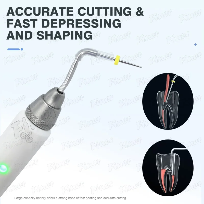 Sistema di otturazione Penna per otturazione endodonzia Endodonzia Taglierina per grondaia Perca Sistema di otturazione del canale radicolare per il riempimento del canale radicolare