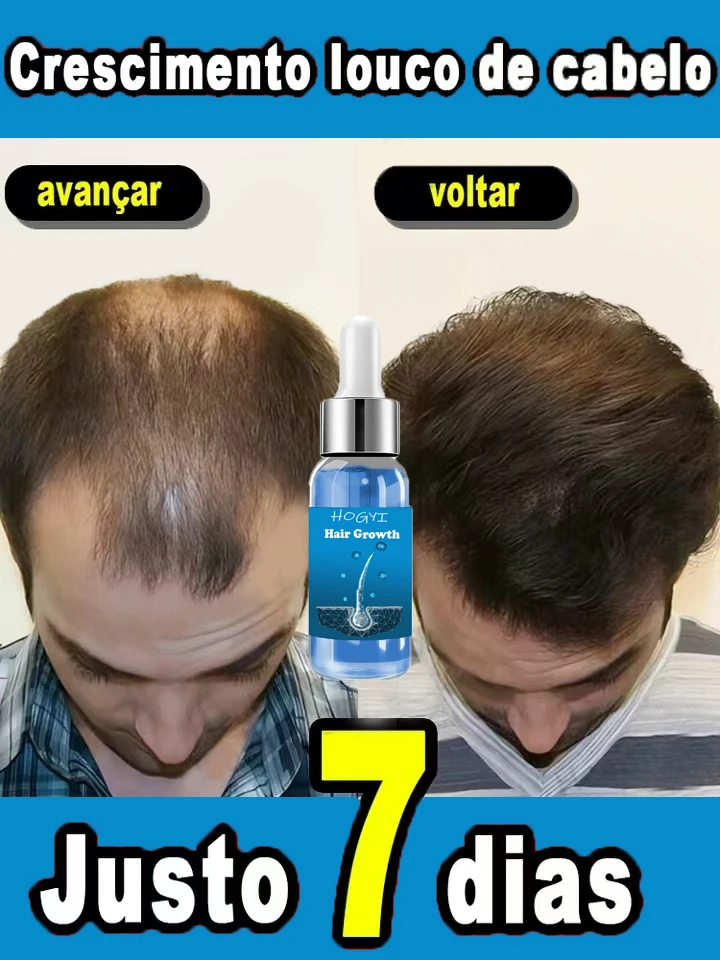 Hot selling product, 99% of buyers buy again, have more and more hair, say goodbye to baldness, thick hair